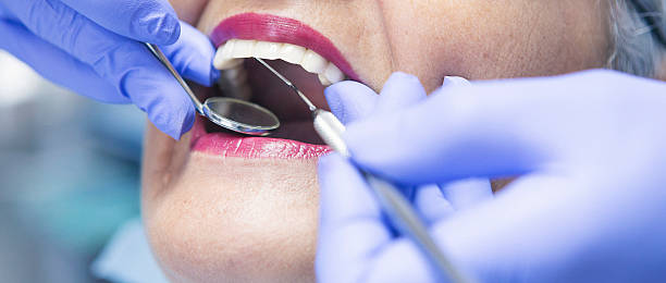 Best Emergency Dental Care for Sports Injuries in Foscoe, NC